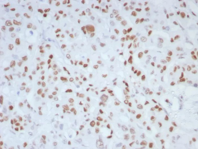 MLH1 (MutL Homolog 1)/HNPCC Antibody in Immunohistochemistry (Paraffin) (IHC (P))