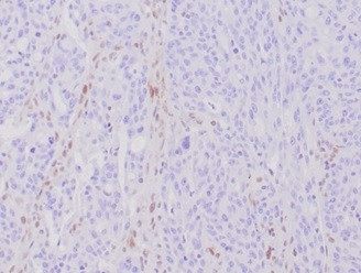 MLH1 (MutL Homolog 1)/HNPCC Antibody in Immunohistochemistry (Paraffin) (IHC (P))