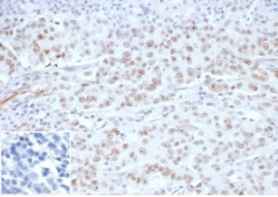 MLH1 (MutL Homolog 1)/HNPCC Antibody in Immunohistochemistry (Paraffin) (IHC (P))