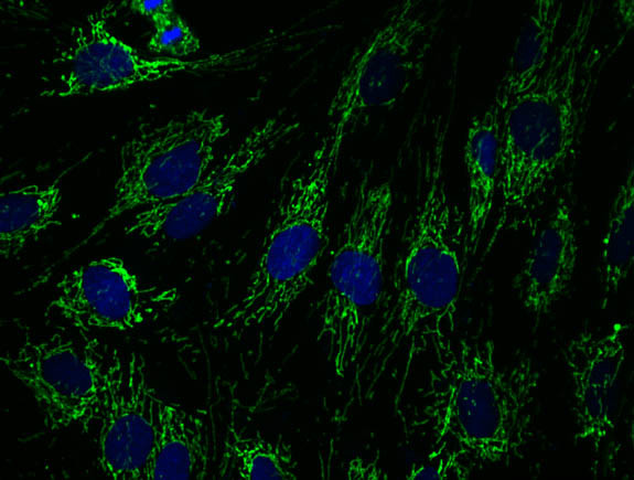 Complex I Antibody in Immunocytochemistry (ICC/IF)