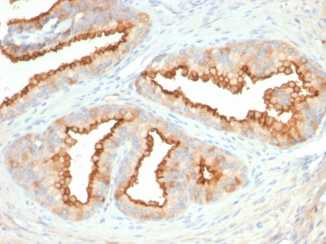 CD10 (Membrane Metalloendopeptidase) Antibody in Immunohistochemistry (Paraffin) (IHC (P))