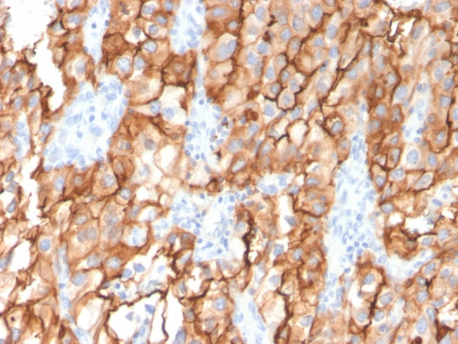 CD10 (Membrane Metalloendopeptidase) Antibody in Immunohistochemistry (Paraffin) (IHC (P))