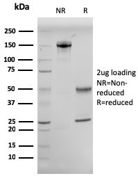 CD10 (Membrane Metalloendopeptidase) Antibody in SDS-PAGE (SDS-PAGE)