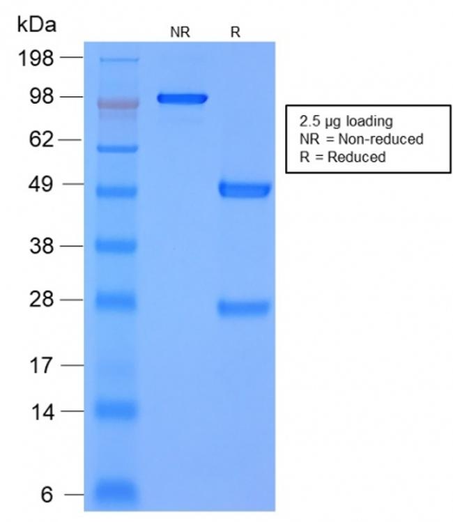 MMP3 Antibody in SDS-PAGE (SDS-PAGE)