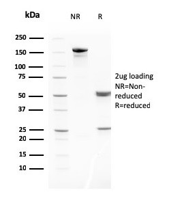 MMP3 (Marker of Metastasis and Rheumatoid Arthritis) Antibody in SDS-PAGE (SDS-PAGE)