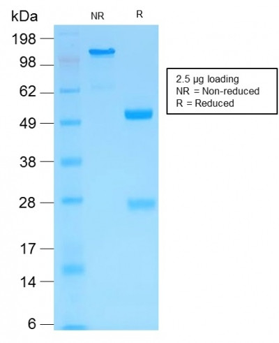 MMP3 (Marker of Metastasis and Rheumatoid Arthritis) Antibody in SDS-PAGE (SDS-PAGE)