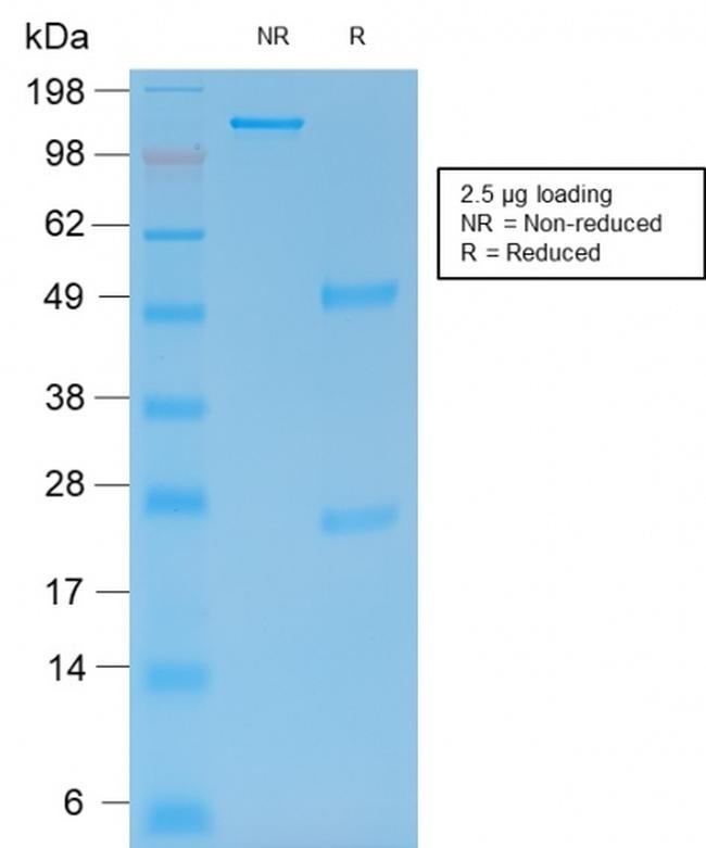 MMP9 (Matrix Metalloproteinase 9) Antibody in SDS-PAGE (SDS-PAGE)