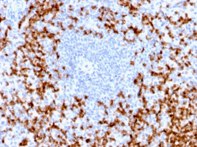 MMP9 (Matrix Metalloproteinase 9) Antibody in Immunohistochemistry (Paraffin) (IHC (P))