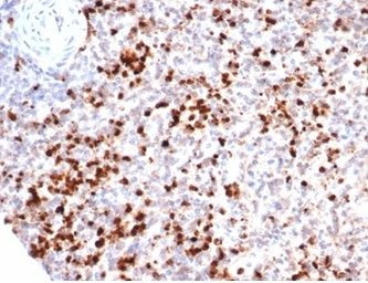 Myeloperoxidase/MPO Antibody in Immunohistochemistry (Paraffin) (IHC (P))