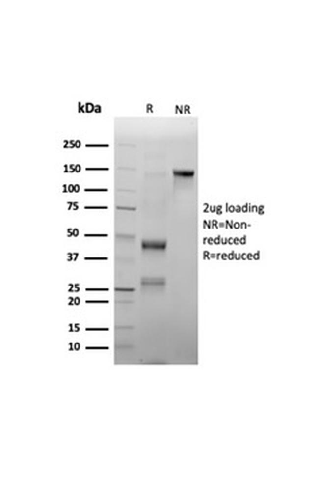 Myeloperoxidase/MPO Antibody in SDS-PAGE (SDS-PAGE)