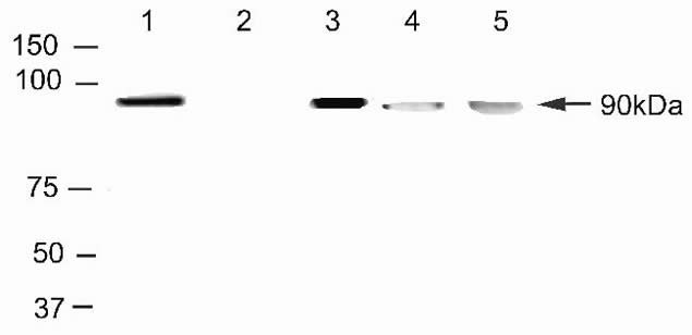 TOP1 Antibody in Immunoprecipitation (IP)