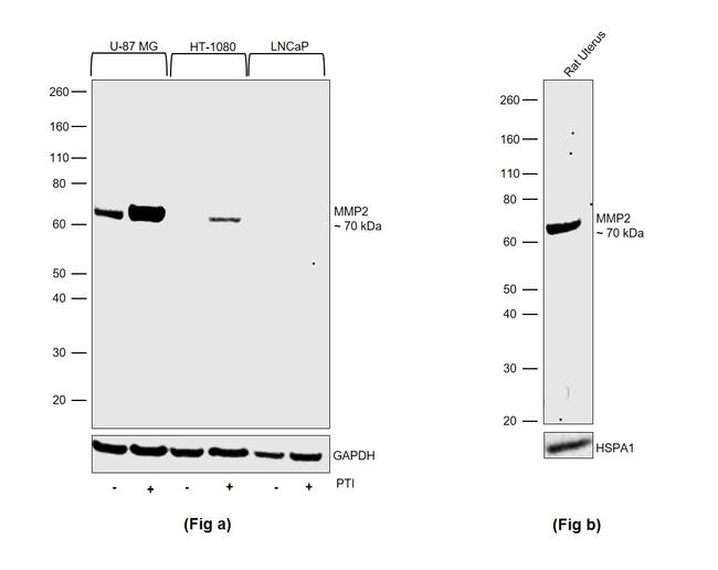 MMP2 Antibody in Western Blot (WB)