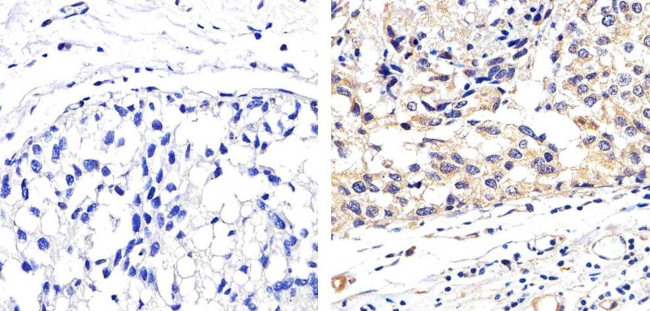 MMP2 Antibody in Immunohistochemistry (Paraffin) (IHC (P))