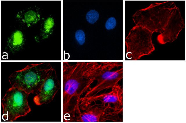 PARP1 Antibody in Immunocytochemistry (ICC/IF)