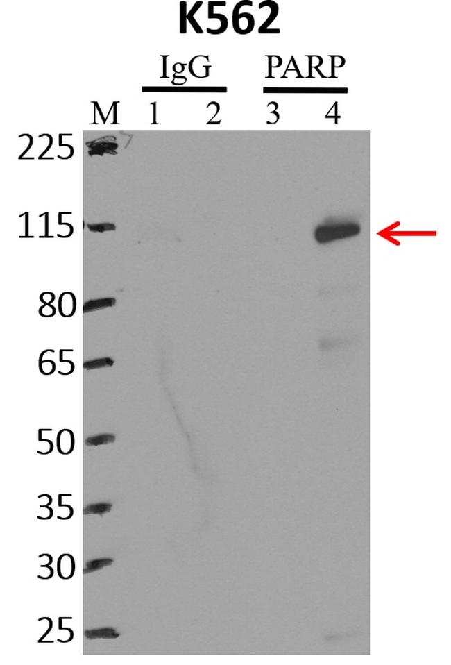 PARP1 Antibody in RNA Immunoprecipitation (RIP)