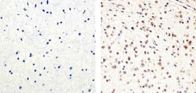 PARP1 Antibody in Immunohistochemistry (Paraffin) (IHC (P))