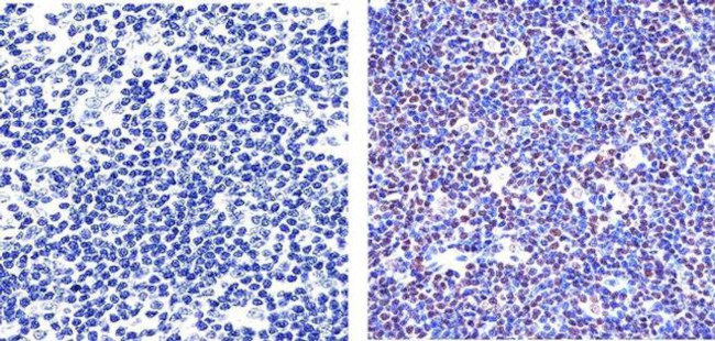 PARP1 Antibody in Immunohistochemistry (Paraffin) (IHC (P))