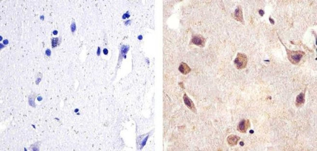 SMAD2 Antibody in Immunohistochemistry (Paraffin) (IHC (P))