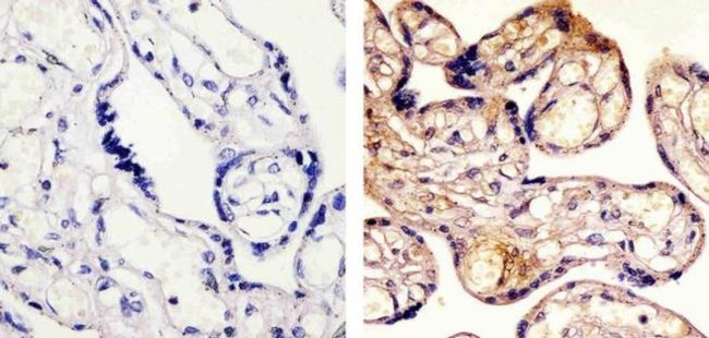 SMAD2 Antibody in Immunohistochemistry (Paraffin) (IHC (P))