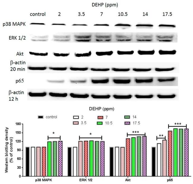 Phospho-p38 MAPK (Thr180, Tyr182) Antibody in Western Blot (WB)