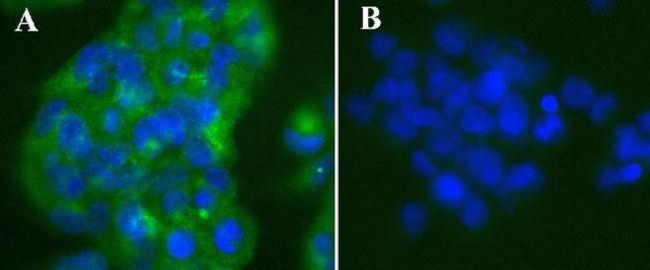 NFkB p65 Antibody in Immunocytochemistry (ICC/IF)