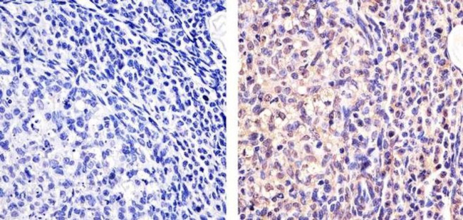 Galectin 1 Antibody in Immunohistochemistry (Paraffin) (IHC (P))