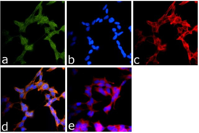 CYLD Antibody in Immunocytochemistry (ICC/IF)