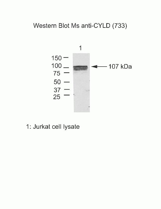 CYLD Antibody in Western Blot (WB)