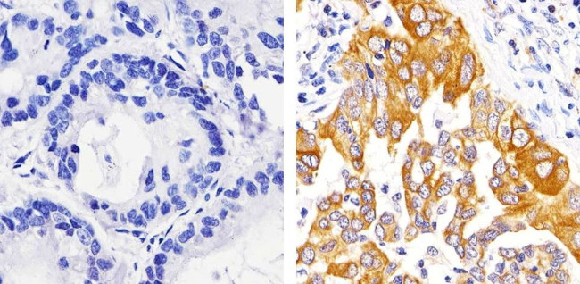 Caspase 3 Antibody in Immunohistochemistry (Paraffin) (IHC (P))