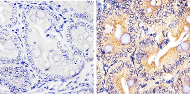 Caspase 3 Antibody in Immunohistochemistry (Paraffin) (IHC (P))