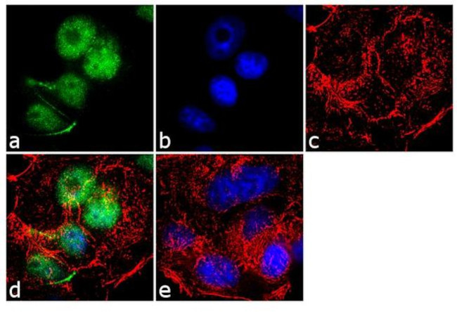 PP1 alpha Antibody in Immunocytochemistry (ICC/IF)