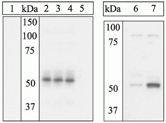 Phospho-ETS1 (Ser282, Ser285) Antibody in Western Blot (WB)