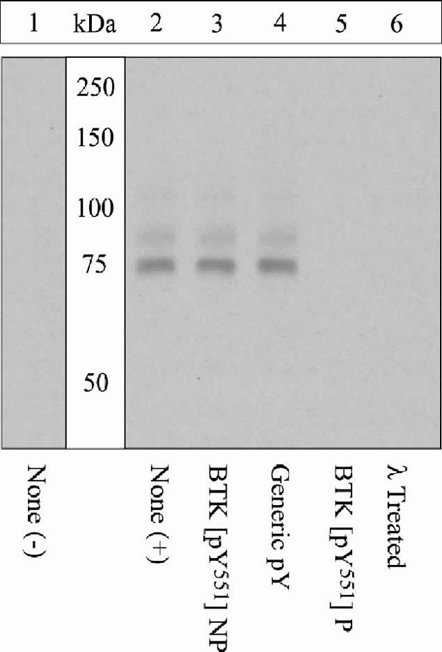 Phospho-Btk (Tyr551) Antibody in Western Blot (WB)