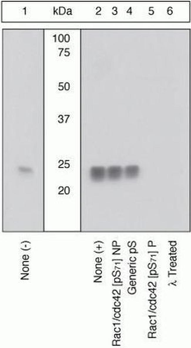 Phospho-RAC1/CDC42 (Ser71) Antibody in Western Blot (WB)