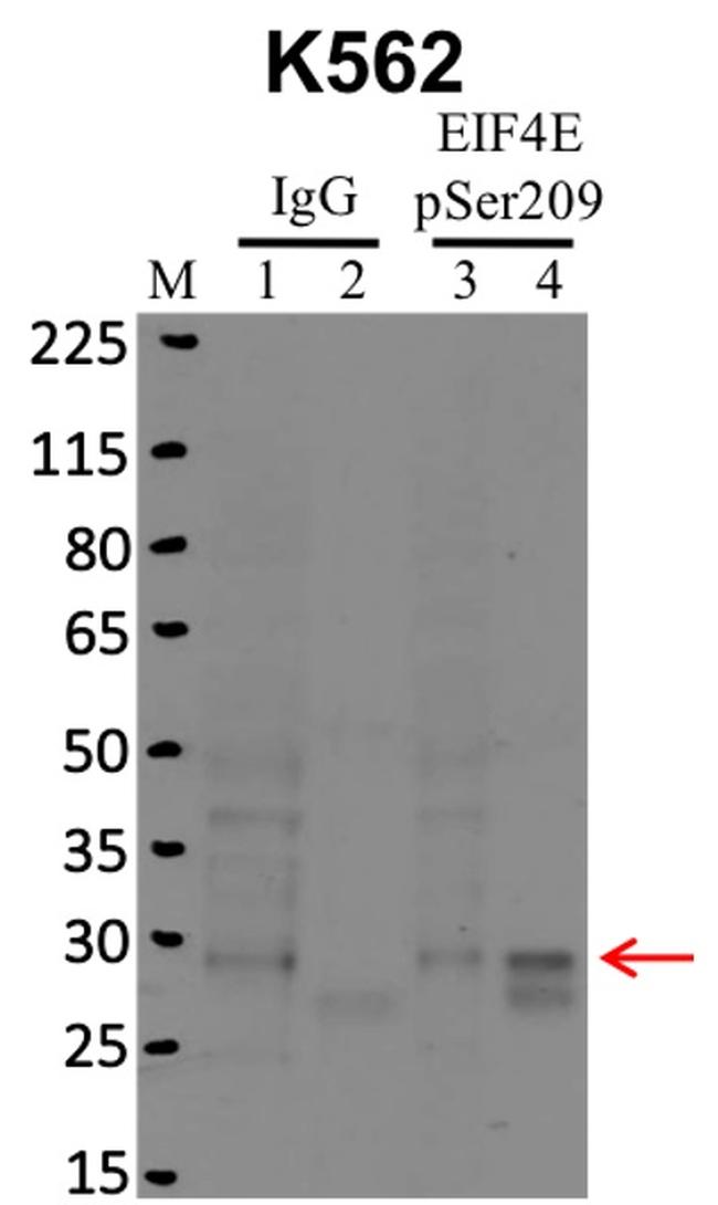 Phospho-eIF4E (Ser209) Antibody in RNA Immunoprecipitation (RIP)