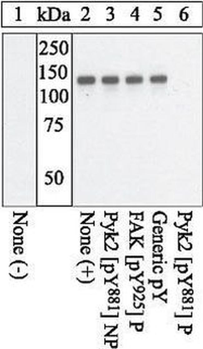 Phospho-PYK2 (Tyr881) Antibody in Western Blot (WB)