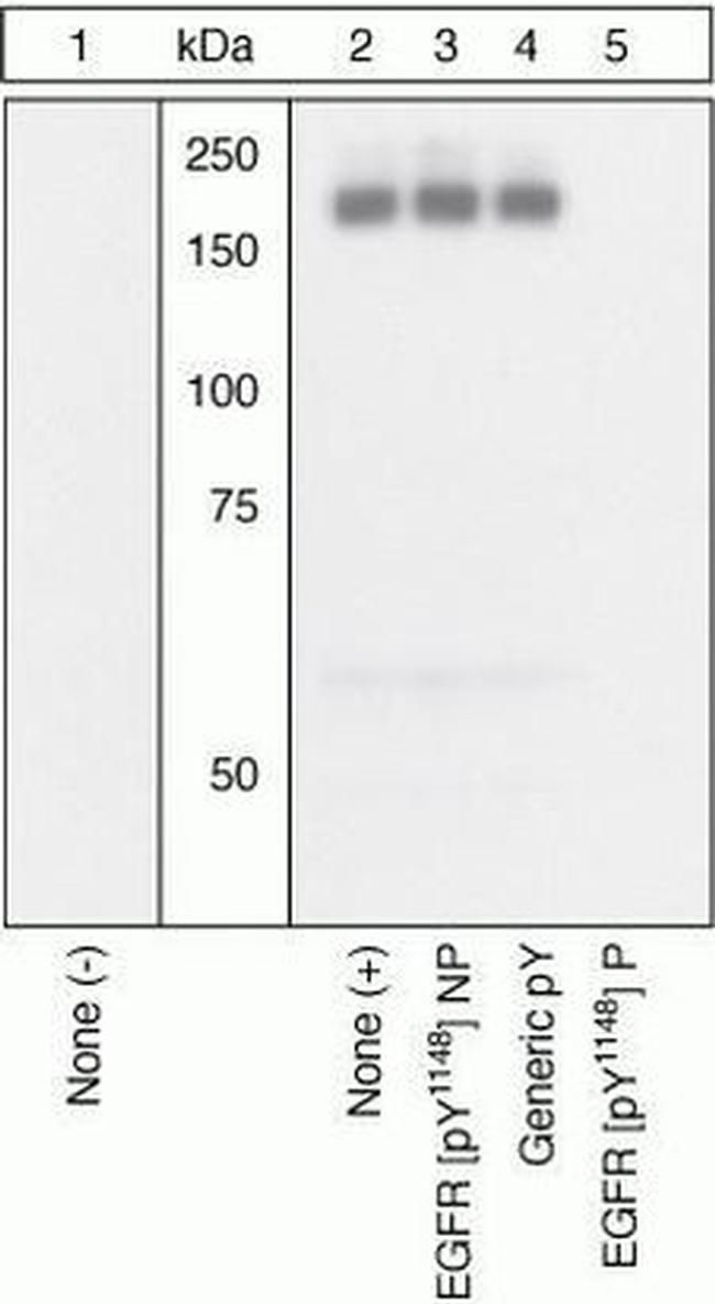 Phospho-EGFR (Tyr1148) Antibody in Western Blot (WB)