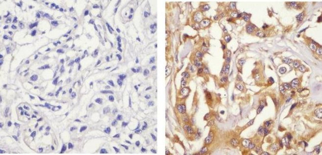 Phospho-Paxillin (Ser126) Antibody in Immunohistochemistry (Paraffin) (IHC (P))