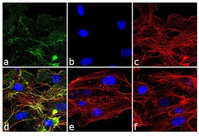 Phospho-VEGF Receptor 2 (Tyr1054, Tyr1059) Antibody