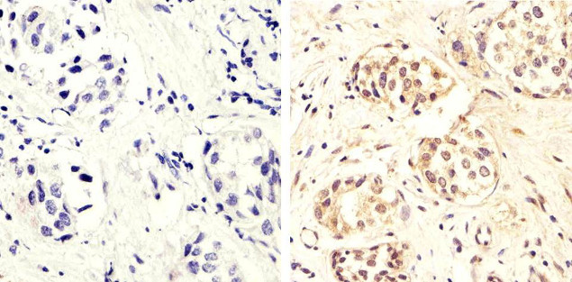 Phospho-PTEN (Ser370) Antibody in Immunohistochemistry (Paraffin) (IHC (P))