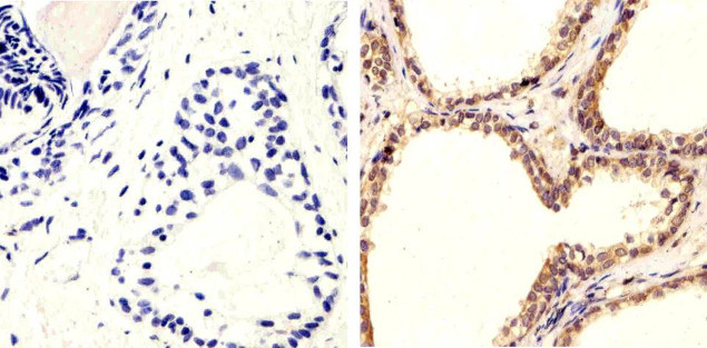 Phospho-PTEN (Ser370) Antibody in Immunohistochemistry (Paraffin) (IHC (P))