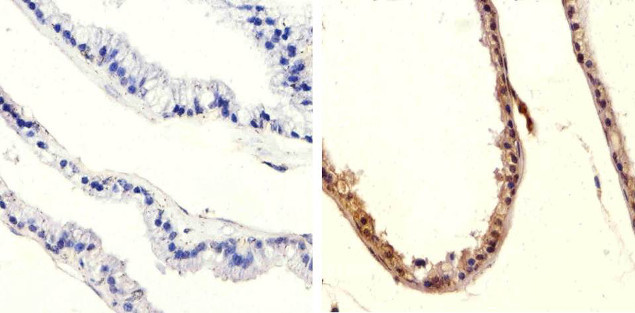 Phospho-PTEN (Ser370) Antibody in Immunohistochemistry (Paraffin) (IHC (P))