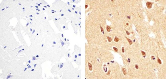 Phospho-PTEN (Thr383) Antibody in Immunohistochemistry (Paraffin) (IHC (P))