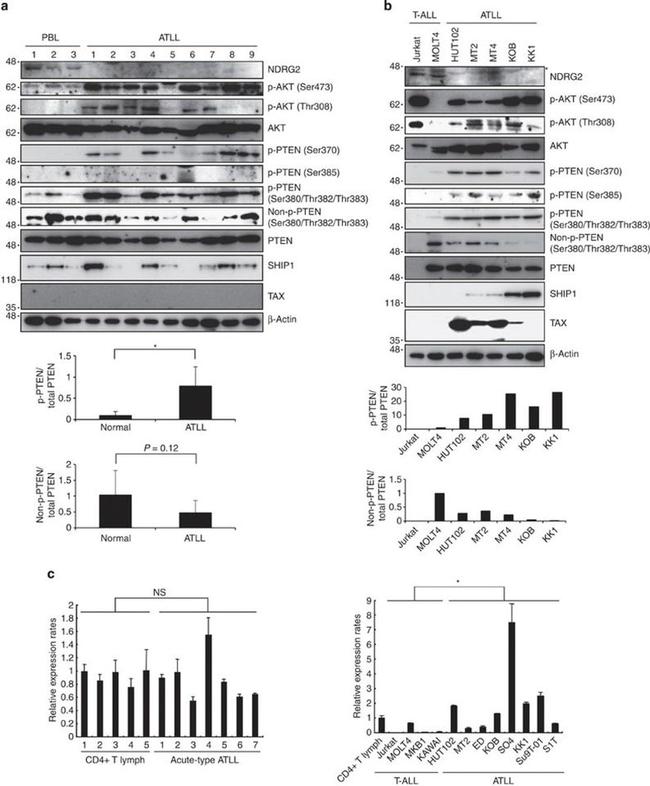 Phospho-PTEN (Ser385) Antibody in Western Blot (WB)