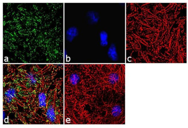 Phospho-Vinculin (Tyr100) Antibody in Immunocytochemistry (ICC/IF)