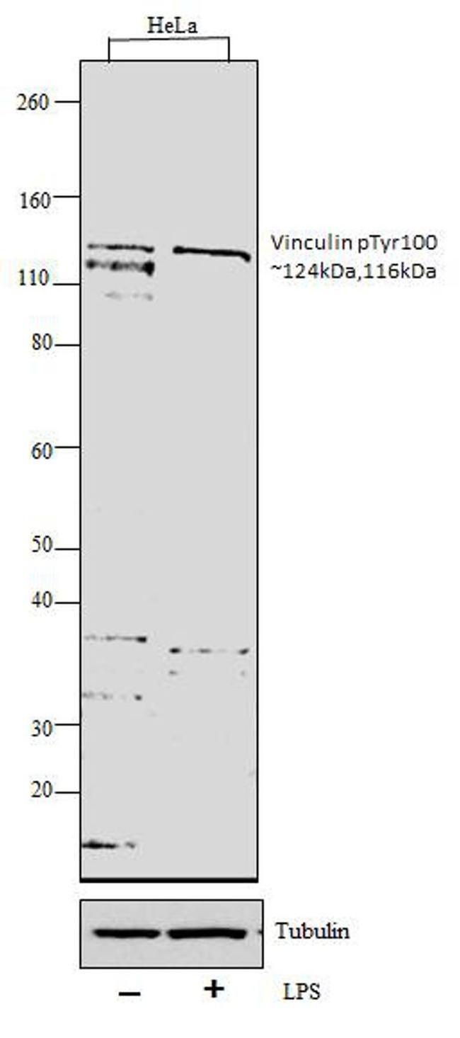 Phospho-Vinculin (Tyr100) Antibody in Western Blot (WB)