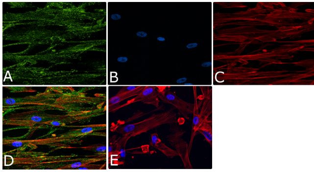 Phospho-Vinculin (Tyr1065) Antibody in Immunocytochemistry (ICC/IF)