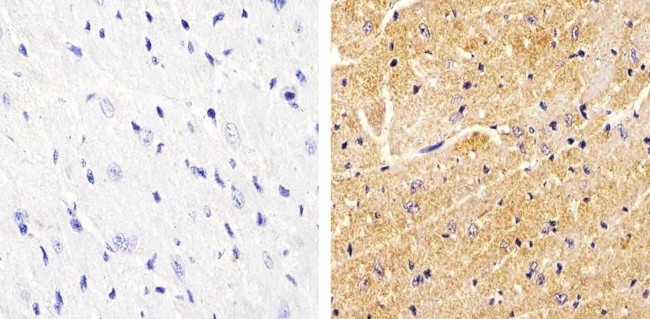 Phospho-Vinculin (Tyr822) Antibody in Immunohistochemistry (Paraffin) (IHC (P))