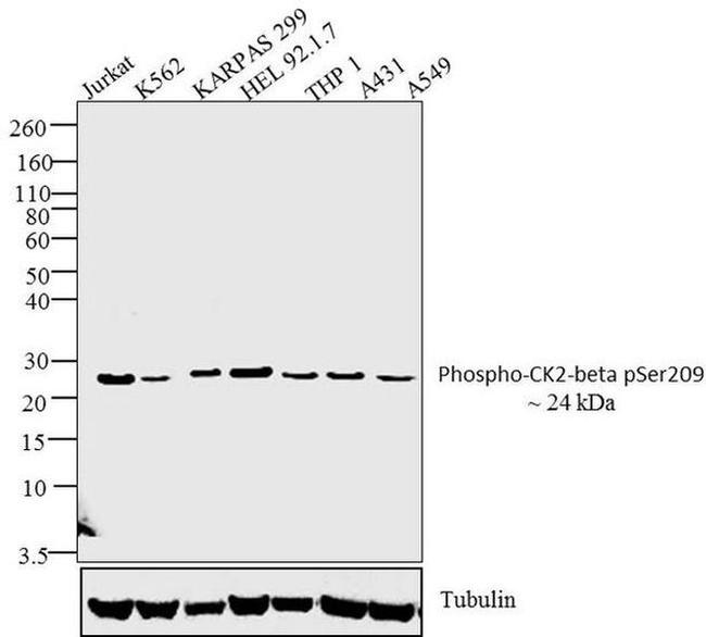 Phospho-CK2 beta (Ser209) Antibody in Western Blot (WB)