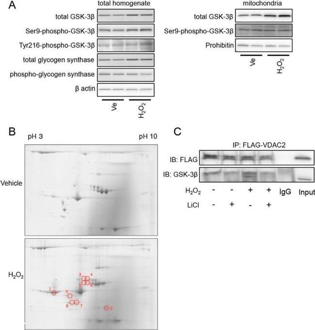 Phospho-GYS1 (Ser641, Ser645) Antibody in Western Blot (WB)